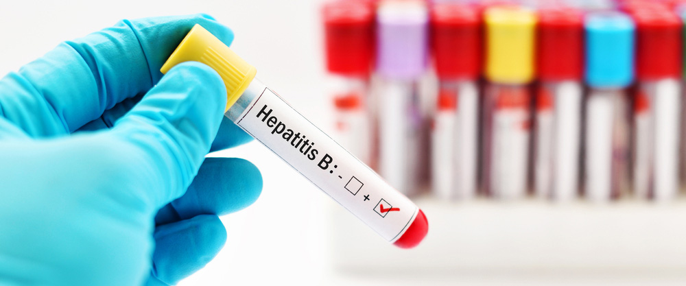 Hepatitis B ဆိုတာဘာလဲ။ ရောဂါလက္ခဏာတွေနဲ့ ကုသနည်းတွေက ဘာတွေလဲ။